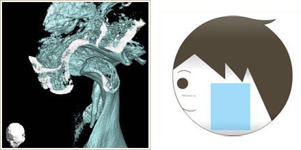 顎関節の横から見たCT画像