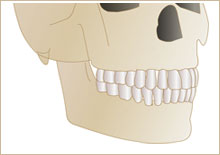 上顎骨の中に上顎洞（サイナス）構造イラスト1