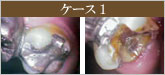 図1