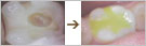 図4