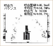 オクルーザーより取得したデータ