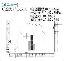 オクルーザーのデータ　噛み合わせ調整前