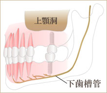 下歯槽管イラスト