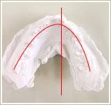 模型による歯列の計測　下顎