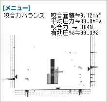 オクルーザーのデータ　噛み合わせ調整前