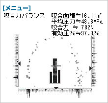 オクルーザーのデータ　噛み合わせ調整後