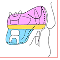 噛み合わせの力関係のイラスト