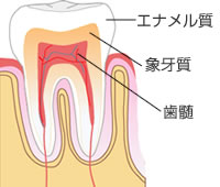 歯の構造のイラスト